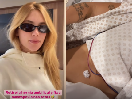 Após cirurgias, Virginia tranquiliza seguidores e mostra que não fez lipoaspiração