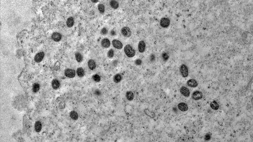 China detecta primeiros casos de nova cepa de mpox