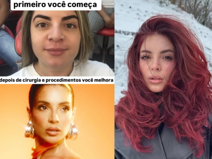 Gkay causa nas redes sociais ao compartilhar antes e depois de procedimentos faciais