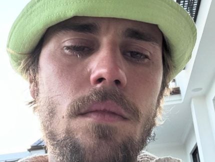 Justin Bieber e a síndrome do impostor: especialista explica sinais de alerta