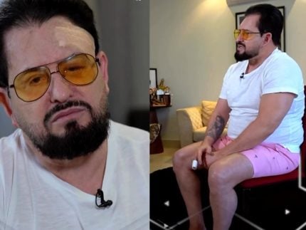 Marrone fala sobre queda do palco no Fantástico: “15 pontos e cinco costelas trincadas”