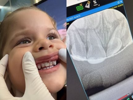 Após acidente, Maria Flor coloca aparelho dentário e Virginia atualiza adaptação