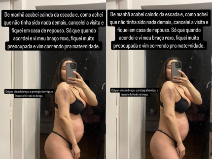 Grávida, Raissa Barbosa cai da escada e vai à emergência do hospital: “Preocupada”