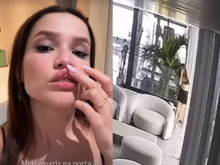 Juliette dá de cara em vidro e mostra como ficou seu rosto após acidente
