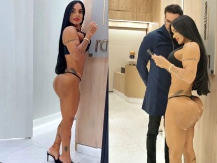 Kamila Simioni passa por procedimento para reparar danos causados por hidrogel no bumbum