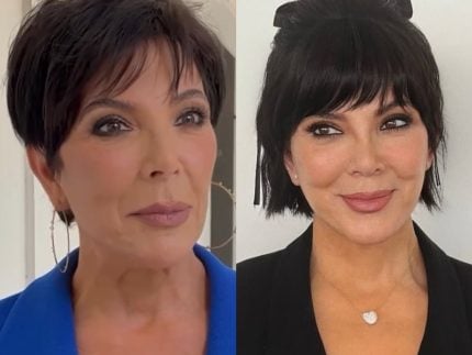 Mãe das Kardashians teria buscado “mestre do lifting facial” para renovar o visual