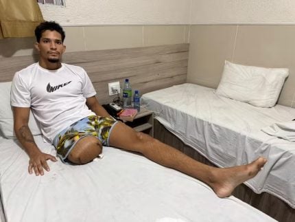 Jovem baleado por delegado em Noronha fala de luta pela vida e amputação