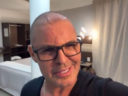 Após procedimento, Eduardo Costa aparece careca em show