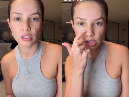 Juliette, campeã do BBB21, retira curativo após acidente doméstico: “Nariz intacto”