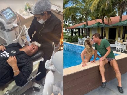 Leonardo faz procedimento estético no rosto a pedido de esposa: “Reclama, mas eu insisto”
