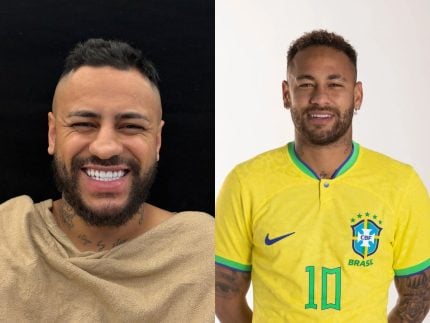 Sósia de Neymar gasta R$40 mil em rinoplastia para reforçar semelhança com o craque