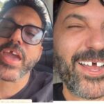 Edson perde dente antes de show e Hudson não perdoa: “Onde tem um dentista urgente?”