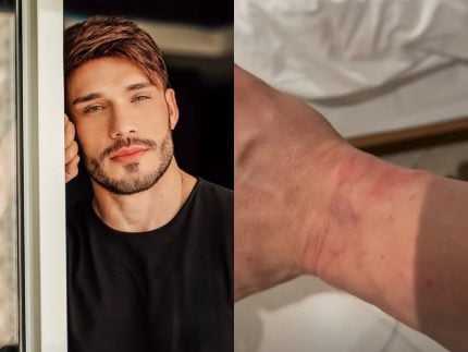 Ex-Fazenda Lucas Viana aparece ferido e diz ter sido detido em Dubai: “Orem por mim”
