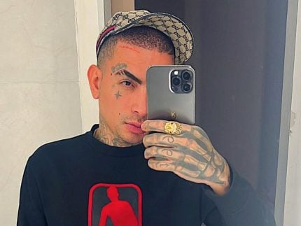 Um novo homem! MC Guimê faz harmonização facial pela 1º vez e exibe resultado