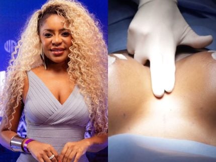 Morre um meme! Cariúcha deixa de ser “toda natural” e exibe resultado de silicone
