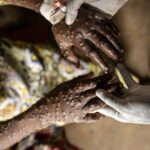 OMS mantém alerta global para epidemia de Mpox