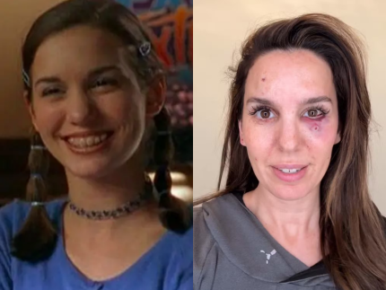 Tiro no rosto e medo da morte: ex-estrela da Disney relembra trauma em festa