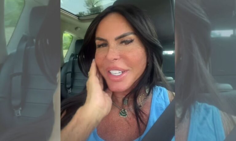 Gretchen rebate uso de filtro e comemora resultado de harmonização facial: ‘Rosto mais fino’